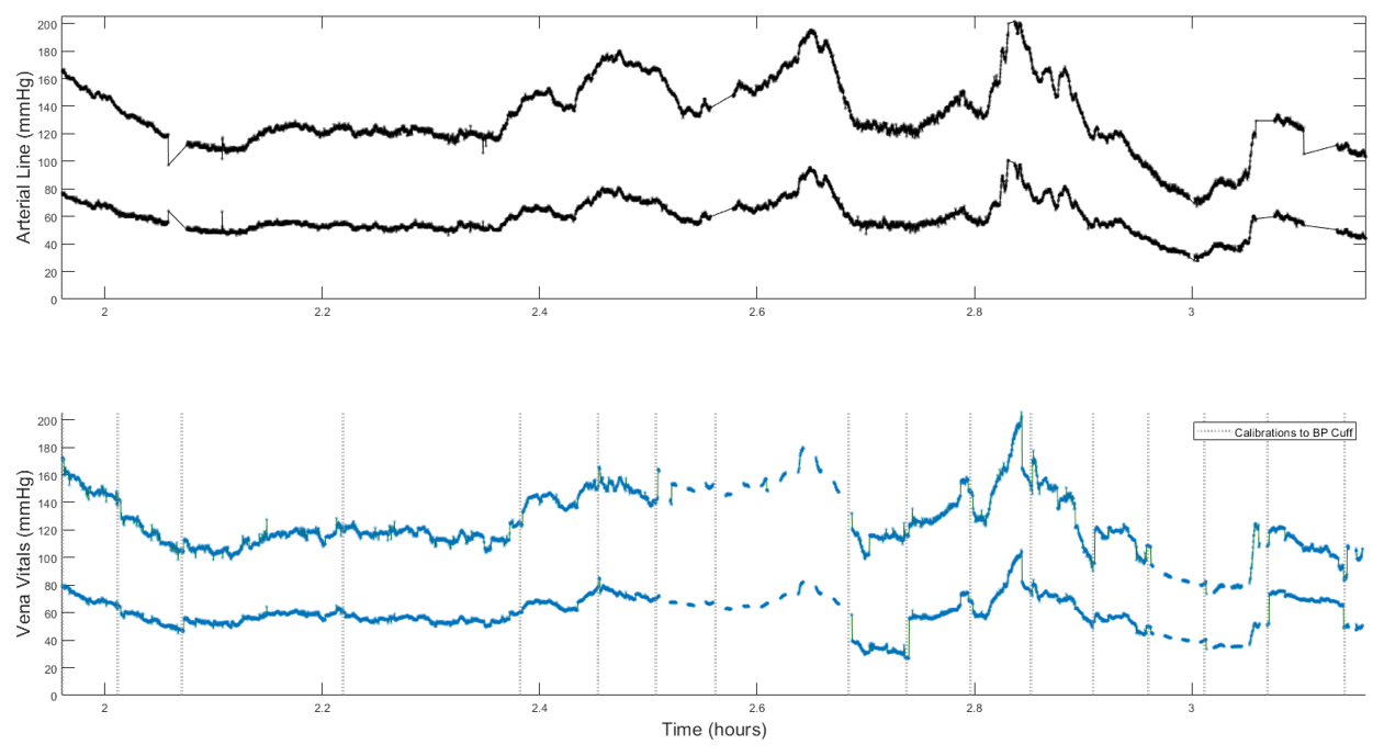 Arterial line and Vena Vitals pressure traces over roughly an hour, plotted one above the other, with calibration points to a blood pressure cuff marked on the lower trace