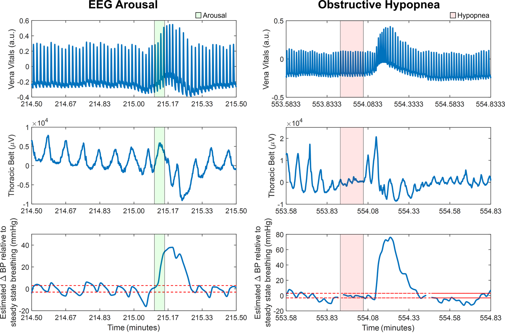 Blood pressure surge magnitudes plotted for arousals and for hypopneas